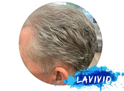 Why Many People Choose Men’s Gray Wigs?