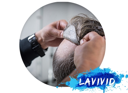 Tips on Actually Applying Your Hair System Perfectly