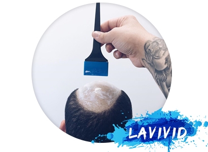 All You Need to Know About Glue On Hair Pieces