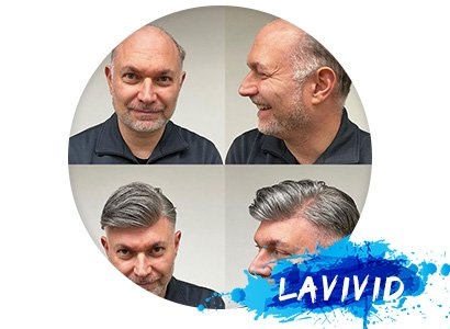 LaVivid Silver Style Sale: Unveil Your Best Look with Exceptional Discounts!