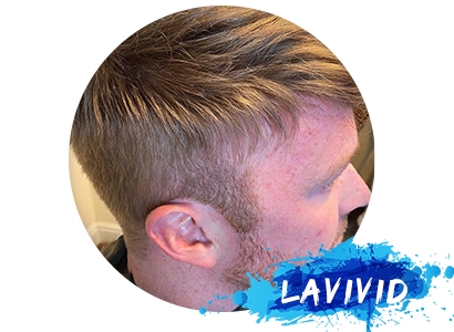 Why Pre-cut Hair Systems Are Popular among Customers?