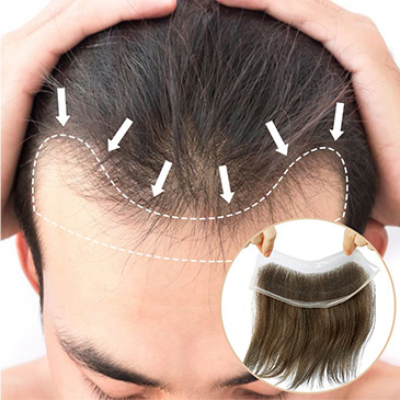 Hairline Patch