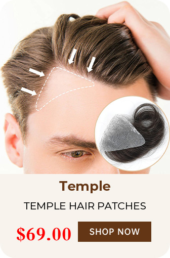 TEMPLE HAIR PATCHES