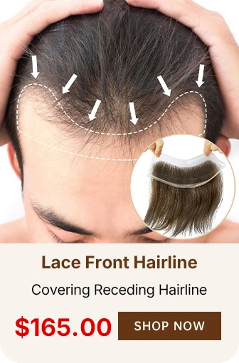 COVERING RECEDING HAIRLINE