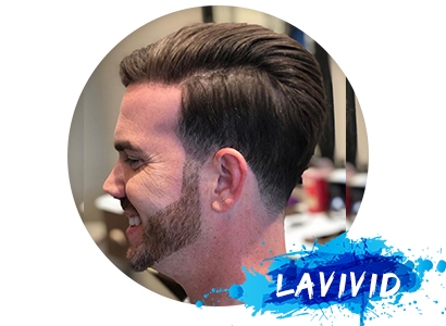 Men's Receding Hairline Treatment
